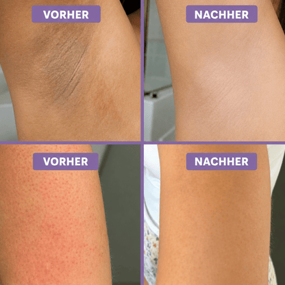 GlowPeel™ | Sanftes Körperpeeling mit Kojisäure & Kurkuma